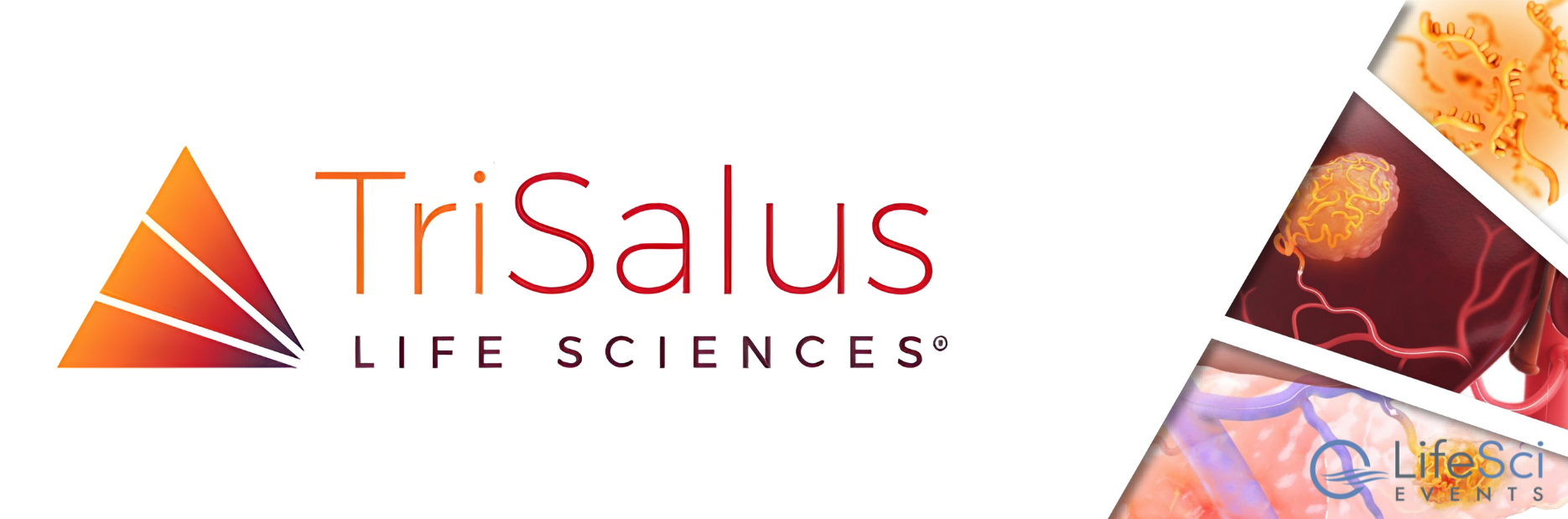 TriSalus-Banner